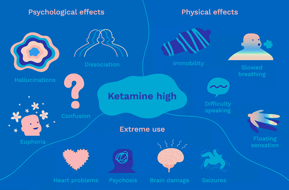 An illustration showing the different effects of a Ketamine high, including psychological effects (hallucinations, dissociation, confusion, and euphoria), physical effects (immobility, slowed breathing, difficulty speaking, and a floating sensation), and adverse effects with extreme use (heart problems, psychosis, brain damage, and seizures).