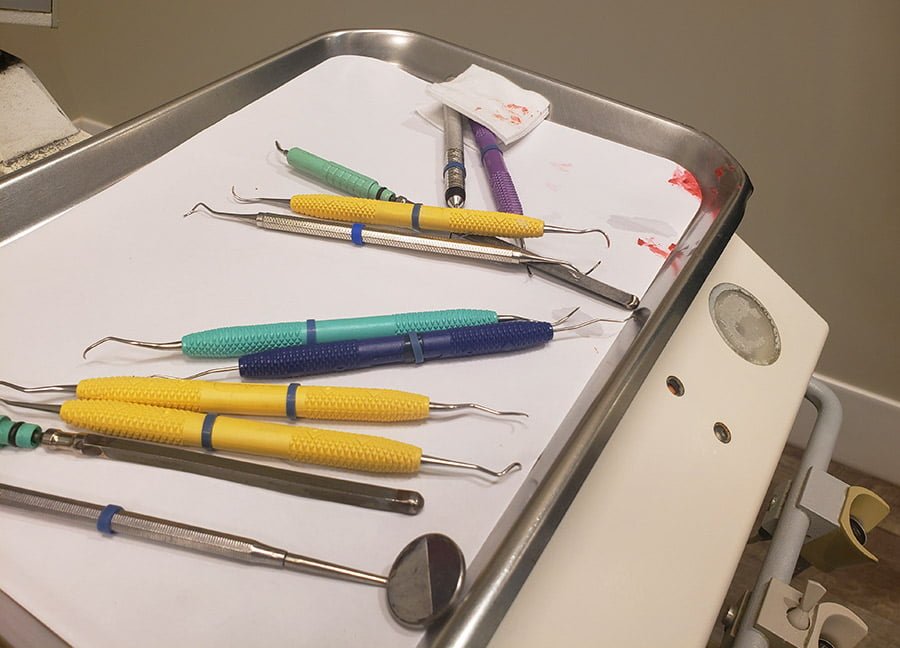A table with dental tools and blood spatter, including small bloody chunks.